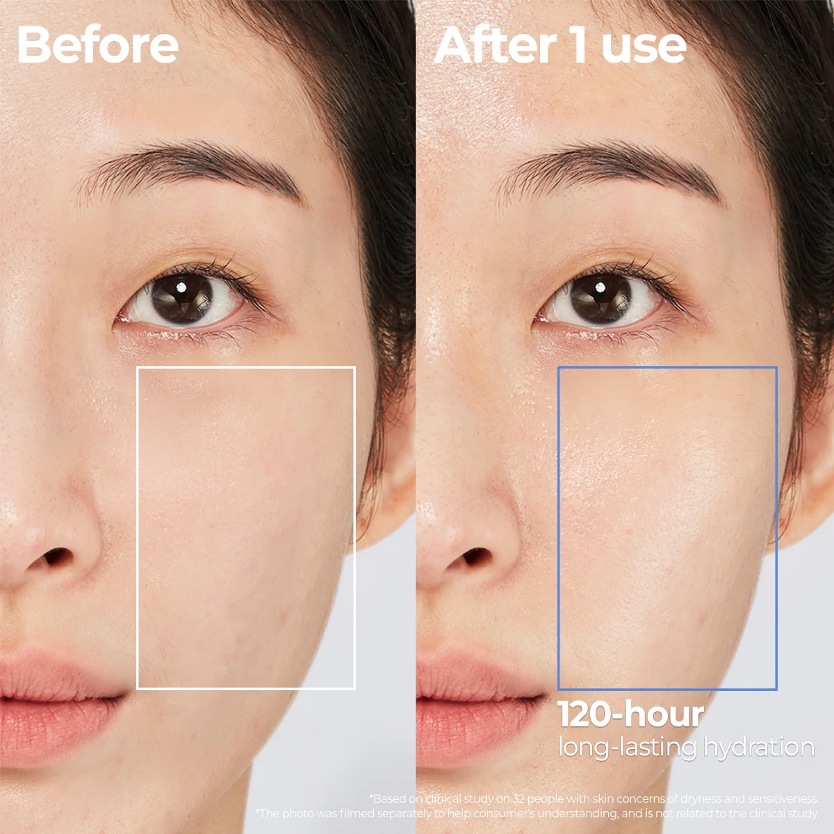 Aestura Atobarrier365 Cream before and after skin barrier improvement
