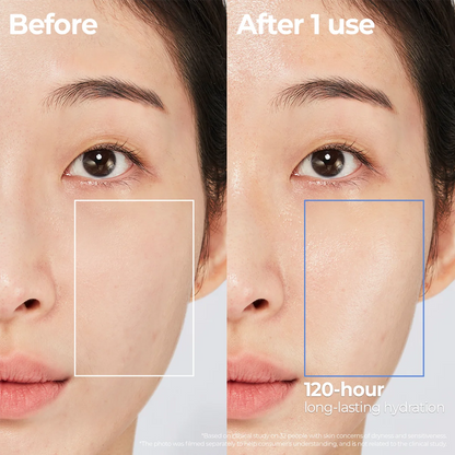 Aestura Atobarrier365 Cream before and after skin barrier improvement