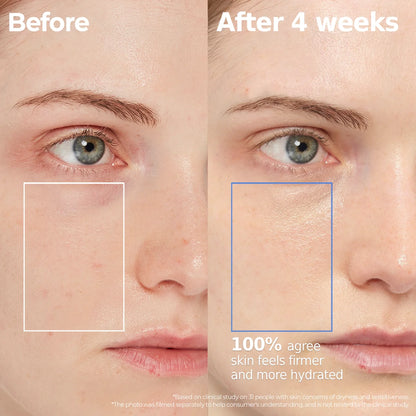 Aestura Atobarrier365 Hydro Cera-HA Serum before and after