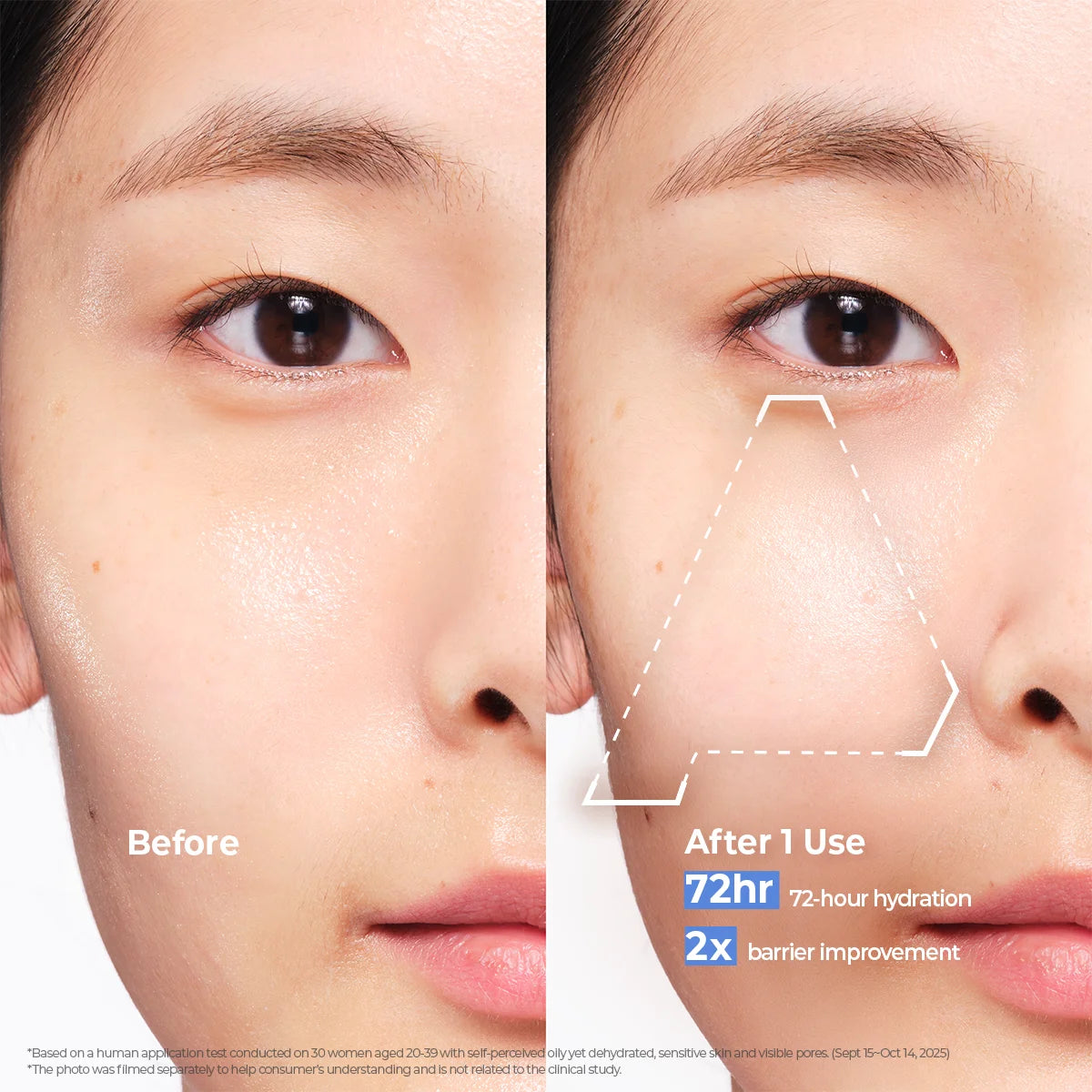 Aestura Atobarrier365 Hydro Soothing Cream before and after