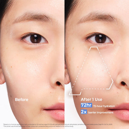 Aestura Atobarrier365 Hydro Soothing Cream before and after
