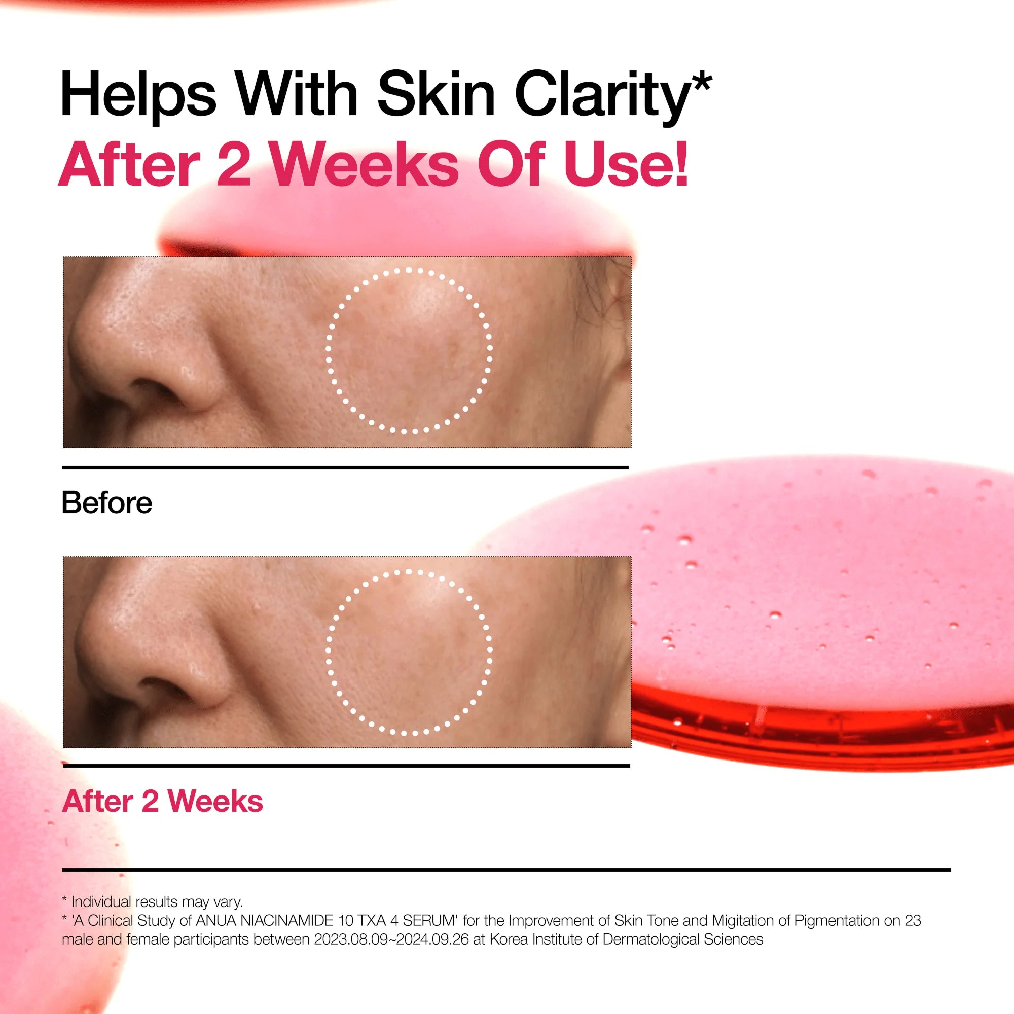 Anua Niacinamide TXA Serum key ingredients